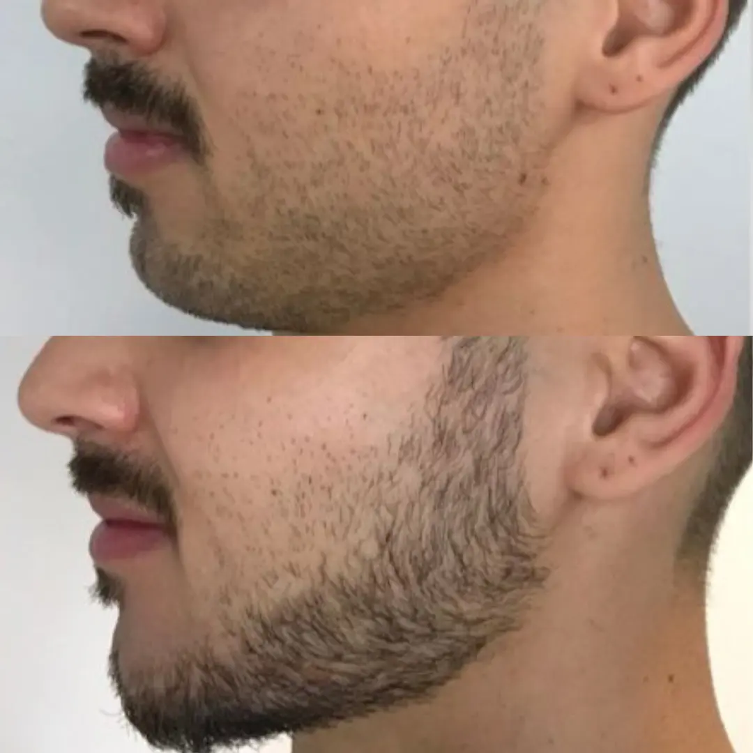 harmonizacao-masculina